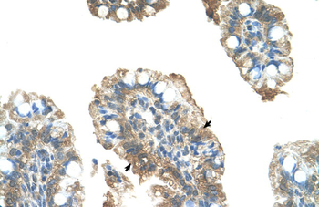 PARP6 Rabbit Polyclonal Antibody