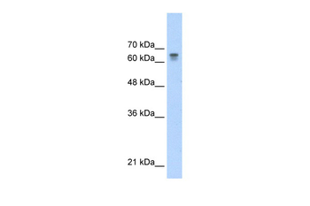 PARP6 Rabbit Polyclonal Antibody