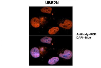 UBE2N Rabbit Polyclonal Antibody