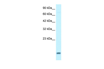 UBE2N Rabbit Polyclonal Antibody