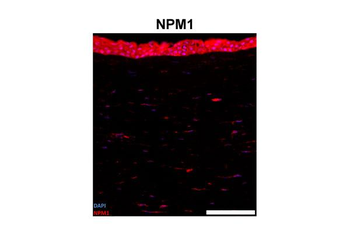 NPM1 Rabbit Polyclonal Antibody