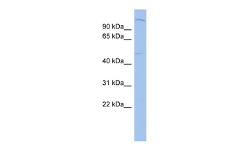 PTGER3 Rabbit Polyclonal Antibody