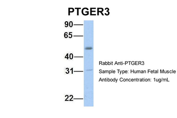 PTGER3 Rabbit Polyclonal Antibody