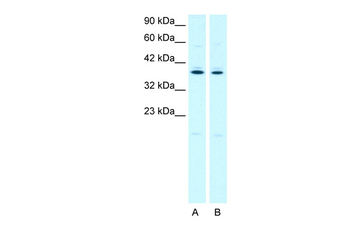 PTGER3 Rabbit Polyclonal Antibody