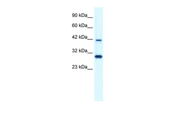 PREB Rabbit Polyclonal Antibody