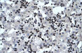 SMARCB1 Rabbit Polyclonal Antibody