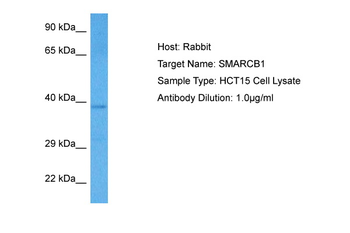 SMARCB1 Rabbit Polyclonal Antibody