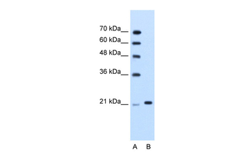 TRIM26 Rabbit Polyclonal Antibody