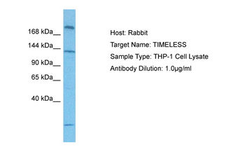 TIMELESS Rabbit Polyclonal Antibody