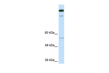 TIMELESS Rabbit Polyclonal Antibody