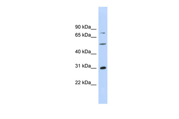 ASPH Rabbit Polyclonal Antibody