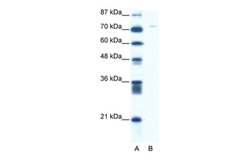 ASPH Rabbit Polyclonal Antibody