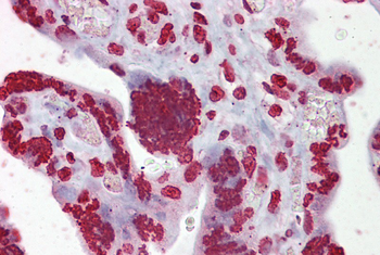 EGR3 Rabbit Polyclonal Antibody