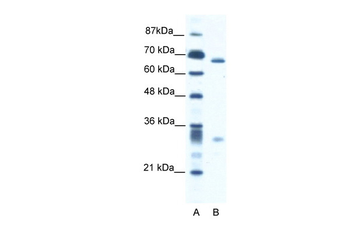ASH2L Rabbit Polyclonal Antibody