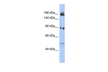 AFF2 Rabbit Polyclonal Antibody