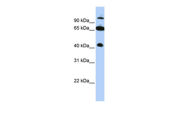 TRIM9 Rabbit Polyclonal Antibody