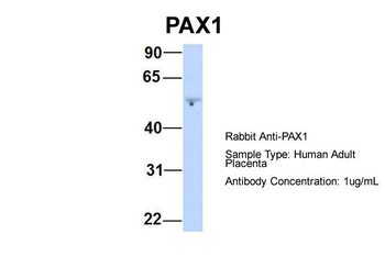PAX1 Rabbit Polyclonal Antibody