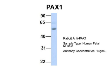 PAX1 Rabbit Polyclonal Antibody