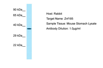 ZFP185 Rabbit Polyclonal Antibody
