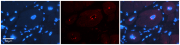 DPF3 Rabbit Polyclonal Antibody