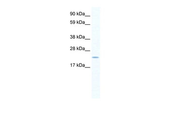 SERTAD1 Rabbit Polyclonal Antibody