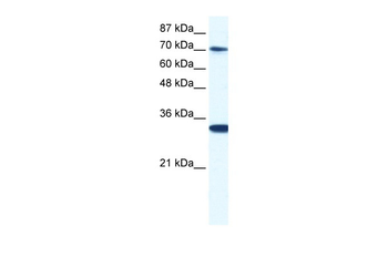 CNOT3 Rabbit Polyclonal Antibody