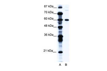 CNOT3 Rabbit Polyclonal Antibody