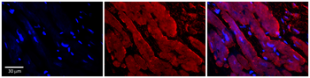 ENO1 Rabbit Polyclonal Antibody