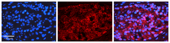 NFKBIB Rabbit Polyclonal Antibody