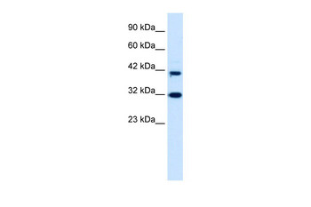 DPF1 Rabbit Polyclonal Antibody