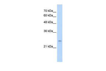 IER2 Rabbit Polyclonal Antibody