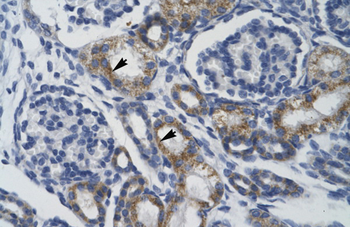TRIM68 Rabbit Polyclonal Antibody