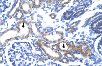 ZA20D3 Rabbit Polyclonal Antibody