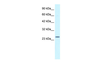 ZA20D3 Rabbit Polyclonal Antibody