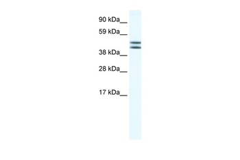 EGLN2 Rabbit Polyclonal Antibody