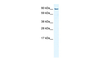 LIMA1 Rabbit Polyclonal Antibody