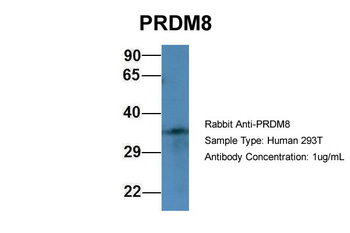 PRDM8 Rabbit Polyclonal Antibody