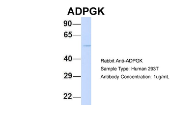 ADPGK Rabbit Polyclonal Antibody