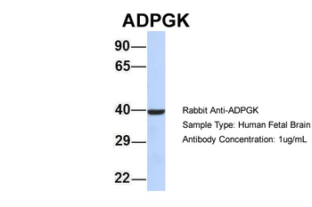 ADPGK Rabbit Polyclonal Antibody