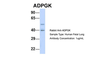 ADPGK Rabbit Polyclonal Antibody