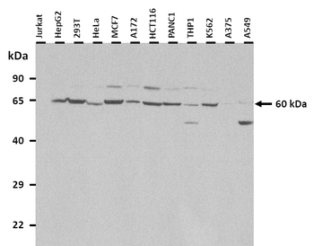 PSIP1 Rabbit Polyclonal Antibody