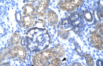 TRIM15 Rabbit Polyclonal Antibody