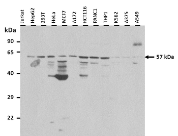 CREB3L2 Rabbit Polyclonal Antibody