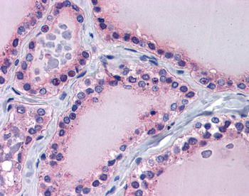 PAX8 Rabbit Polyclonal Antibody