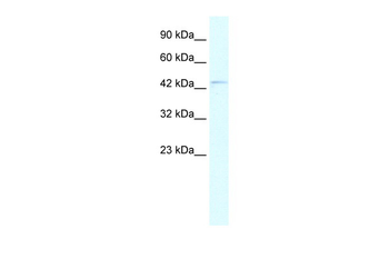 PAX5 Rabbit Polyclonal Antibody