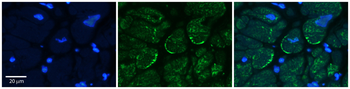 ASPH Rabbit Polyclonal Antibody