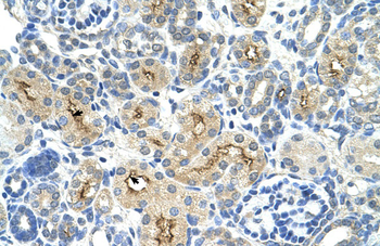 TAF6 Rabbit Polyclonal Antibody