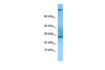 Tsc22d2 Rabbit Polyclonal Antibody
