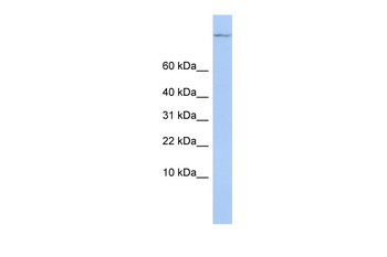 TSC22D1 Rabbit Polyclonal Antibody