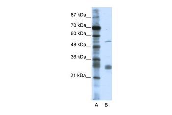 LRRC14 Rabbit Polyclonal Antibody